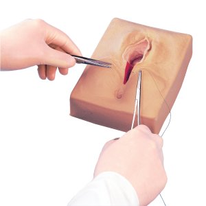 Episiotomy and Suture