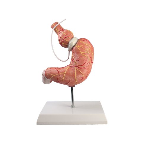 Stomach model with gastric band