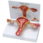 Gebärmutter-Eierstock-Modell