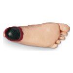 GERi/KERi Edema foot with deep tissue injury