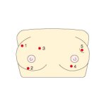 Inspection and Palpation of Breast Cancer Trainer