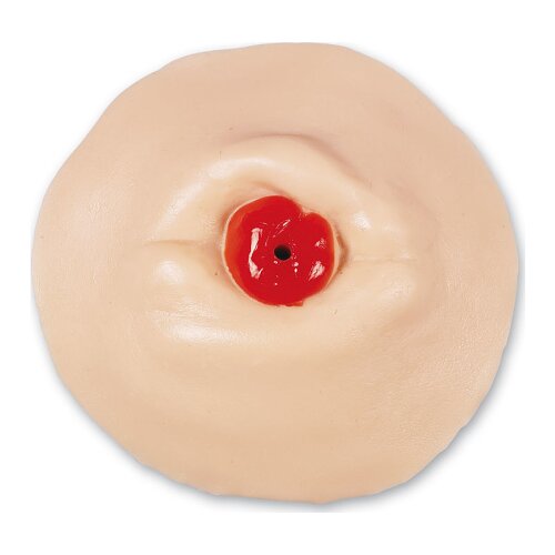 Retracted Ostomy Care Training Model