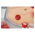 Kompletter Stoma-Simulator