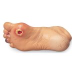 Advanced Foot Problems