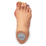 Advanced Foot Problems