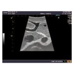 Ultraschall-Modell Abdomen