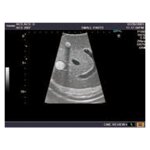 Ultraschall-Modell Abdomen