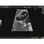 Ultraschall-Modell Abdomen