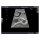 Abdominal Intraoperative & Laparoscopic Ultrasound Phantom