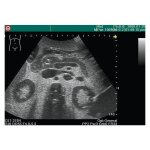 Ultrasound Training model Anatomy / Pathology