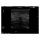 Breast Ultrasound Examination Phantom