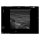 Breast Ultrasound Examination Phantom