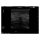 Breast Ultrasound Examination Phantom