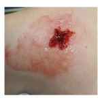 EZ wounds – professional wound simulation set