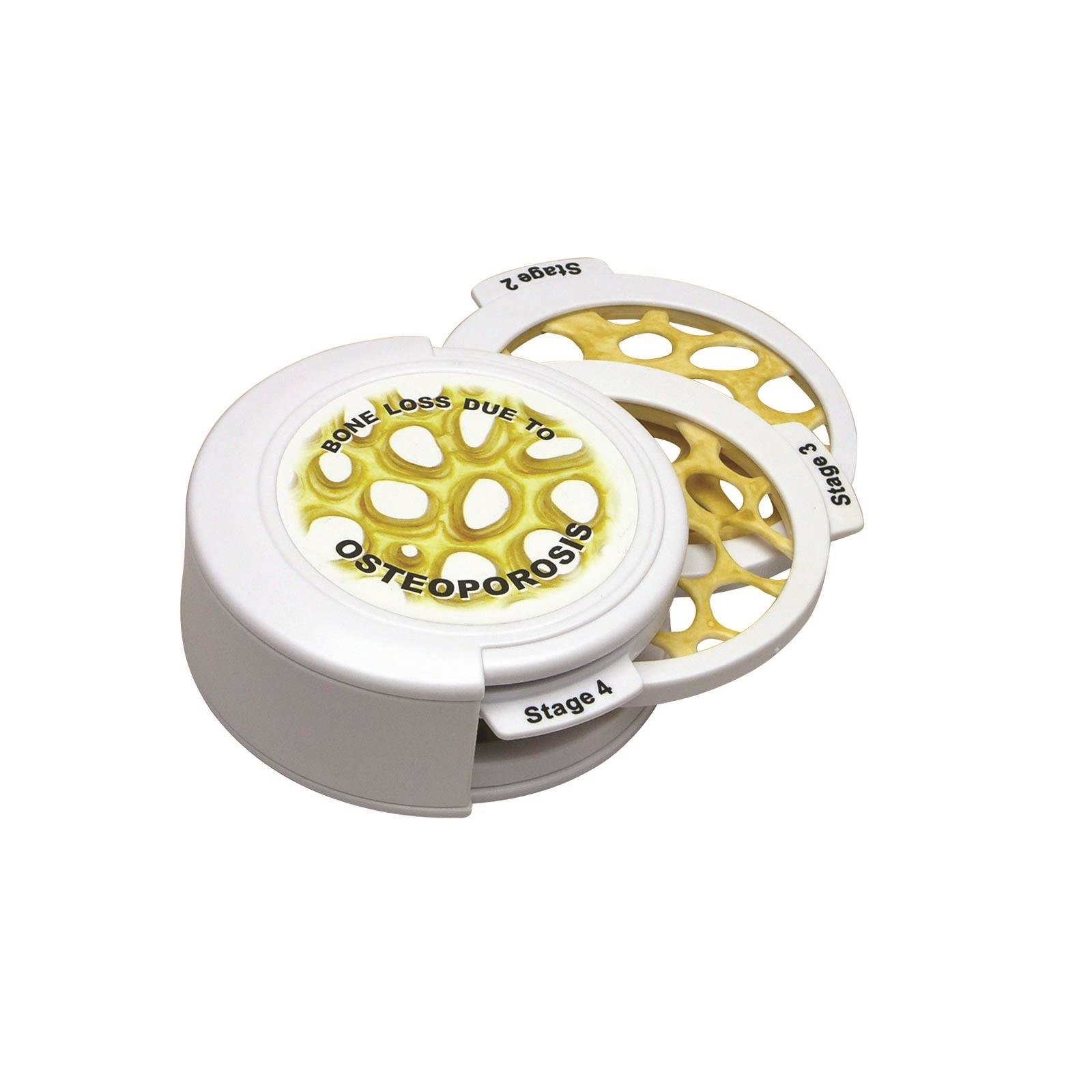 Osteometry Set 4-Stage Osteoporosis Hinged Disk Set GPI Anatomicals 1650 1019509