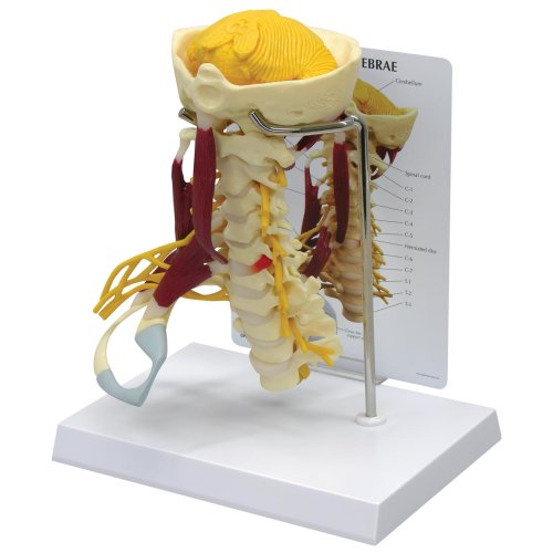 Halswirbelsäule-Modell mit Muskeln