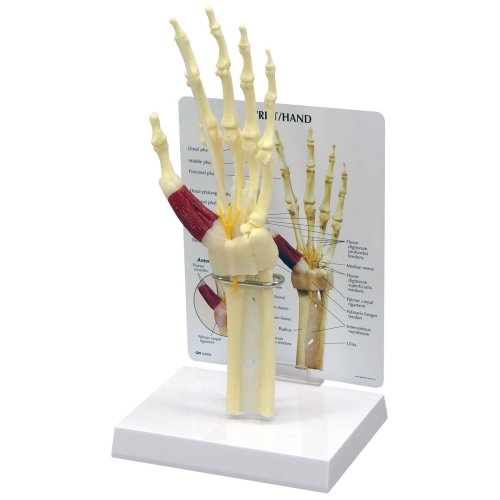 Hand/Wrist Carpal Tunnel Syndrome Model