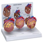 3-Mini Heart Model Set