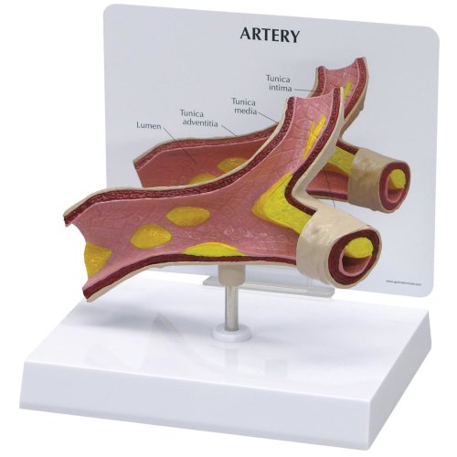 Arterien-Modell