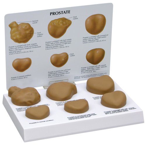 Prostata-Modell