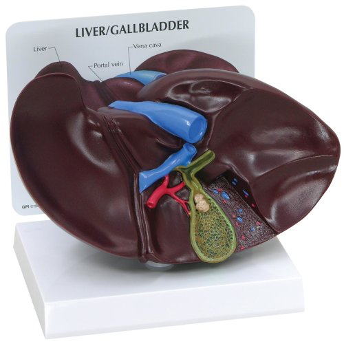 Liver/Gallbladder Model with Gallstones
