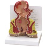 Rektum-Querschnitt-Modell mit Pathologien