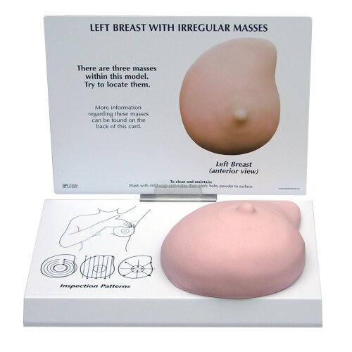 Left Breast Model with Irregular Masses (W33385)