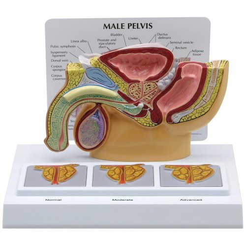 Becken-Modell männlich mit 3D-Prostata-Rahmen