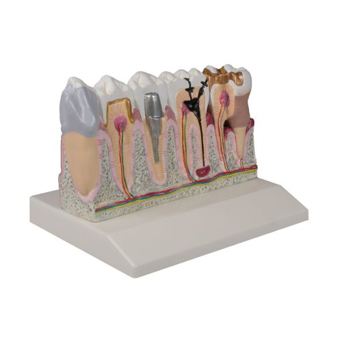 Dental model, 4 times life-size