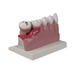Dental-Modell, 4-fache Gr&ouml;&szlig;e