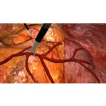 Lap-X Hybrid Laparoscopy Simulator