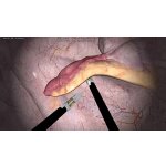 Lap-X Hybrid Laparoscopy Simulator