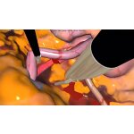 Lap-X Hybrid Laparoscopy Simulator