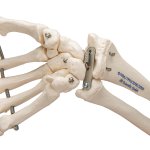 Handskelett-Modell mit Unterarm, auf Draht gezogen - 3B Smart Anatomy
