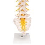 Lumbar Spine Model with Dorso-Lateral Prolapsed Intervertebral Disc - 3B Smart Anatomy