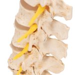 Stages of Disc Prolapse and Vertebral Degeneration Model - 3B Smart Anatomy
