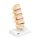 Stages of Disc Prolapse and Vertebral Degeneration Model - 3B Smart Anatomy