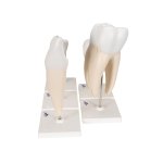 Serie mit 5 Zahn-Modelle - 3B Smart Anatomy