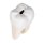 Zahn-Modell Unterer zweiwurzeliger Molar mit Karies, 2-tlg - 3B Smart Anatomy