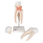Upper Triple-Root Molar Tooth Model, 3 part - 3B Smart Anatomy
