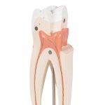 Zahn-Modell Oberer dreiwurzeliger Molar, 3-tlg - 3B Smart Anatomy