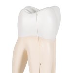 Zahn-Modell Oberer dreiwurzeliger Molar, 3-tlg - 3B Smart Anatomy