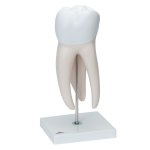 Giant Molar with Dental Cavities Tooth Model, 15x magnified, 6 part - 3B Smart Anatomy