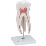 Zahn-Modell Oberer dreiwurzeliger Mahlzahn, 5-tlg - 3B Smart Anatomy