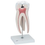 Zahn-Modell Oberer dreiwurzeliger Mahlzahn, 5-tlg - 3B Smart Anatomy