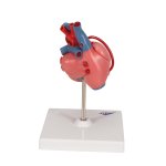 Heart Model with Bypass, 2 part - 3B Smart Anatomy