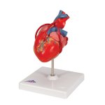 Herz-Modell mit Bypass, 2-tlg - 3B Smart Anatomy