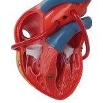 Herz-Modell mit Bypass, 2-tlg - 3B Smart Anatomy