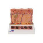 Skin Cancer Model with 5 stages, 8x magnified - 3B Smart Anatomy