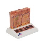 Skin Cancer Model with 5 stages, 8x magnified - 3B Smart Anatomy